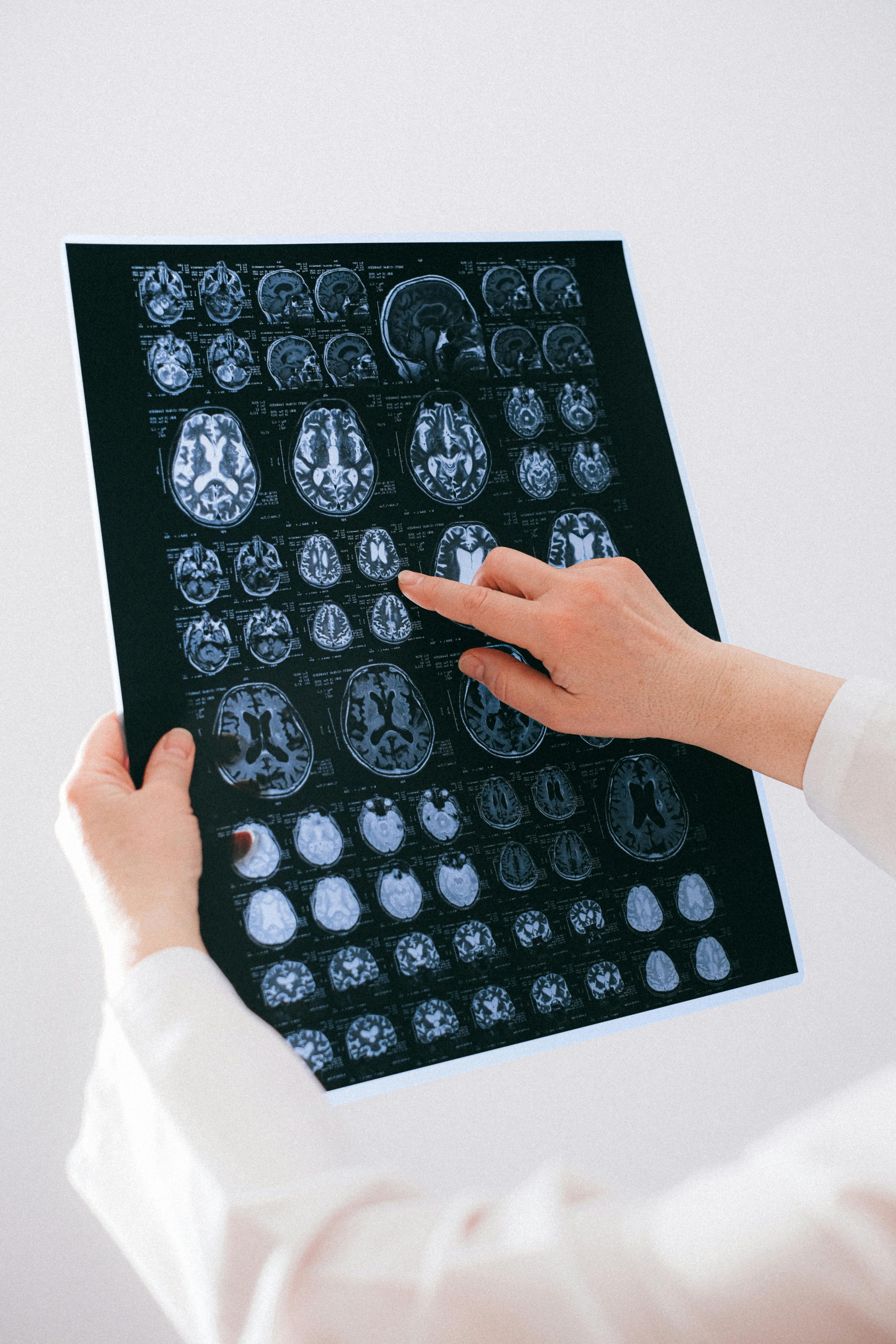 Epilepsie chirurgie